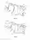 Fig. 08 - Expanding interbody implant and articulating inserter and method