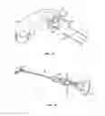 Fig. 09 - Expanding interbody implant and articulating inserter and method