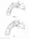 Fig. 11 - Expanding interbody implant and articulating inserter and method