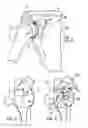 Fig. 02 - GLENOID COMPONENT INSTALLATION PROCEDURE AND TOOLING FOR SHOULDER ARTHROPLASTY