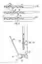 Fig. 03 - GLENOID COMPONENT INSTALLATION PROCEDURE AND TOOLING FOR SHOULDER ARTHROPLASTY