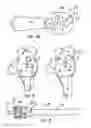 Fig. 04 - GLENOID COMPONENT INSTALLATION PROCEDURE AND TOOLING FOR SHOULDER ARTHROPLASTY