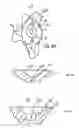 Fig. 05 - GLENOID COMPONENT INSTALLATION PROCEDURE AND TOOLING FOR SHOULDER ARTHROPLASTY
