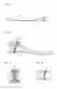 Fig. 06 - Foot prosthesis