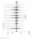 Fig. 12 - Method for amplifying signals from individual nerve fascicles