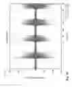 Fig. 19 - Method for amplifying signals from individual nerve fascicles