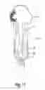 Fig. 13 - PROSTHETIC SOCKET SUSPENSION DEVICE EMBODIMENTS