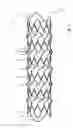 Fig. 04 - Stent