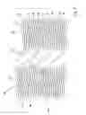 Fig. 11 - Stent