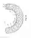 Fig. 03 - Balloon expandable endoprosthesis