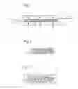 Fig. 02 - Stent device, a crimping head, and an outer sheath of a stent device delivery system