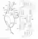 Fig. 01 - Patella cup