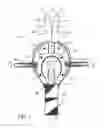 Fig. 02 - Patella cup