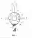 Fig. 03 - Patella cup