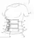 Fig. 01 - Compression Garment for Postpartum Women