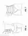 Fig. 07 - Compression Garment for Postpartum Women