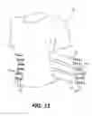 Fig. 10 - Compression Garment for Postpartum Women