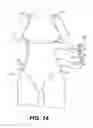 Fig. 11 - Compression Garment for Postpartum Women