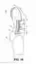 Fig. 13 - Compression Garment for Postpartum Women