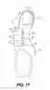 Fig. 14 - Compression Garment for Postpartum Women