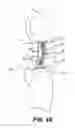 Fig. 15 - Compression Garment for Postpartum Women