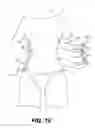 Fig. 16 - Compression Garment for Postpartum Women