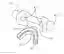 Fig. 01 - Device and method for the treatment of bruxism