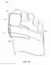 Fig. 15 - THERMAL THERAPEUTIC GARMENTS