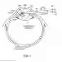 Fig. 08 - Image-guided eye surgery apparatus