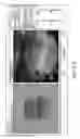 Fig. 38 - Image-guided eye surgery apparatus