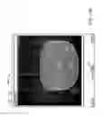 Fig. 40 - Image-guided eye surgery apparatus