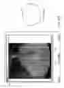 Fig. 42 - Image-guided eye surgery apparatus