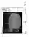 Fig. 43 - Image-guided eye surgery apparatus