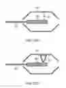 Fig. 46 - Image-guided eye surgery apparatus