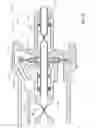 Fig. 05 - Traction-limiting vitrecetomy probe