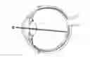 Fig. 01 - Apparatus and Corneal Remodeling Methods to Improve Vision in Macular Disease