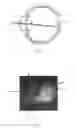 Fig. 02 - Apparatus and Corneal Remodeling Methods to Improve Vision in Macular Disease