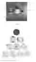 Fig. 03 - Apparatus and Corneal Remodeling Methods to Improve Vision in Macular Disease