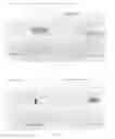 Fig. 06 - Apparatus and Corneal Remodeling Methods to Improve Vision in Macular Disease