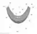 Fig. 03 - GOGGLE SYSTEM WITH AN INTERCHANGEABLE LENS