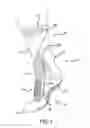 Fig. 02 - Wound dressing garment