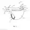 Fig. 02 - Cloth diaper with adjustment features
