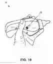 Fig. 16 - Self-paced ergonomic infant feeding bottle