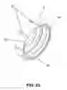 Fig. 47 - Self-paced ergonomic infant feeding bottle