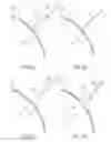 Fig. 03 - Devices and methods for percutaneous endoscopic gastrostomy and other ostomy procedures