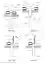 Fig. 14 - Devices and methods for percutaneous endoscopic gastrostomy and other ostomy procedures