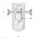 Fig. 03 - System generating a constraint field, and medical device implementing the same