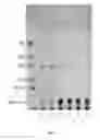 Fig. 04 - Triacylglycerol-based lipid composition