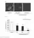 Fig. 02 - COMPOSITION FOR SUPPRESSING ADIPOCYTE DIFFERENTIATION, FOR REDUCING FAT ACCUMULATION AND/OR FOR PROMOTING ADIPONECTIN SECRETION AND USAGE FOR SAID COMPOSITION