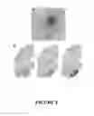 Fig. 02 - Method for preventing and/or treating chronic traumatic encephalopathy-I